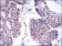 KID Primary Antibody  MP30277 [M1E3]