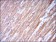TNNI2 Primary Antibody MP30278 [M2F12A8]