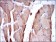 TNNI2 Primary Antibody MP30278 [M2F12A8]