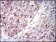 G6PD Primary Antibody MP30287 [M2H7]