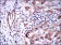 GSTM1 Primary Antibody MP30295 [M1H4A4]