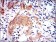 GSTM1 Primary Antibody MP30296 [M1H4F2]