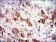 TUBA8 Primary Antibody MP30301 [M2D6]