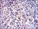 BIRC5 Primary Antibody MP30303 [M1H5]