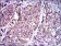 SERPINE1 Primary Antibody MP30306 [M1D5]
