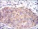 SERPINE1 Primary Antibody MP30306 [M1D5]