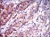 NEFL Primary Antibody MP30310 [M1H3]