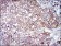 NEFL Primary Antibody MP30313 [M2G10]