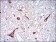 NEFL Primary Antibody MP30313 [M2G10]
