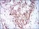 SKP1 Primary Antibody MP30316 [M1H9]
