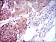 RPS6KB1 Primary Antibody MP30319 [M5G9]