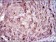 CRP Primary Antibody MP30335 [M1G1]