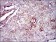 FN1 Primary Antibody MP30339 [M2F4]