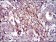 FN1 Primary Antibody MP30339 [M2F4]