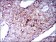 CK5 Primary Antibody MP30349 [M2C2]