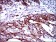 CK5 Primary Antibody MP30349 [M2C2]