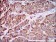 CCL2 Primary Antibody MP30351 [M2D8]