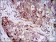 HSP90AA1 Primary Antibody MP30356 [M5G5]