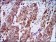 HSP90AA1 Primary Antibody MP30356 [M5G5]