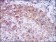 HAS3 Primary Antibody MP30357 [M3C9]