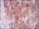 PRKACG Primary Antibody MP30366 [M2E4]