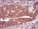 PRKACG Primary Antibody MP30366 [M2E4]
