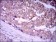 GPC3 Primary Antibody MP30372 [M9C2]