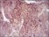 MELK Primary Antibody MP30374 [M2G2]