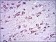 DCX Primary Antibody MP30381 [M2G5]