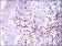 PAX5 Primary Antibody MP30395 [M7D3]
