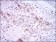 PLK1 Primary Antibody MP30396 [M3C11]