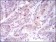 PLK1 Primary Antibody MP30396 [M3C11]