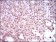 SRY Primary Antibody MP30397 [M1G4]