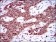 SRY Primary Antibody MP30397 [M1G4]