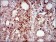 PIK3R1 Primary Antibody MP30402 [M6G10]