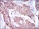 PTPN11 Primary Antibody MP30409 [M6D9]