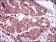 PTPN11 Primary Antibody MP30409 [M6D9]