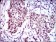 FOXP1 Primary Antibody MP30413 [M6E4]