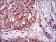 ILK Primary Antibody MP30415 [M3A9]
