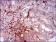 ILK Primary Antibody MP30415 [M3A9]