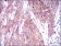 MARK3 Primary Antibody MP30418 [M2G12]