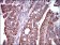 STAT5A Primary Antibody MP30423 [M6D4]