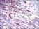 CD59 Primary Antibody MP30428 [M8D2B8]