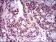 T Primary Antibody MP30430 [M1H9A2]