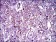 ABCB5 Primary Antibody MP30432 [M5H3C6]