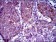 ABCB5 Primary Antibody MP30432 [M5H3C6]