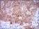 CDKN2A Primary Antibody MP30434 [M1D7D2]