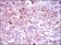 ACLY Primary Antibody MP30437 [M5F8D11]
