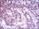 ACLY Primary Antibody MP30437 [M5F8D11]