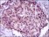 MEF2C Primary Antibody MP30439 [M6H2G2]